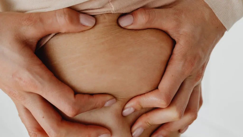 woman showing the cocoa butter benefits on her stretch marks
